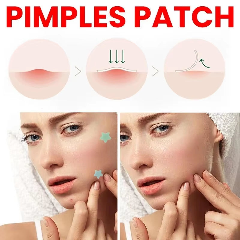 Pimple Patch